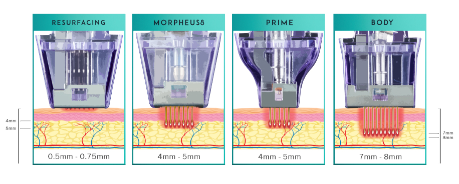 morpheus-rajeunissement-grenoble